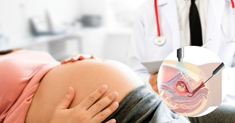 Hướng dẫn mẹ bầu cách đọc kết quả xét nghiệm sàng lọc trước sinh chính xác 3