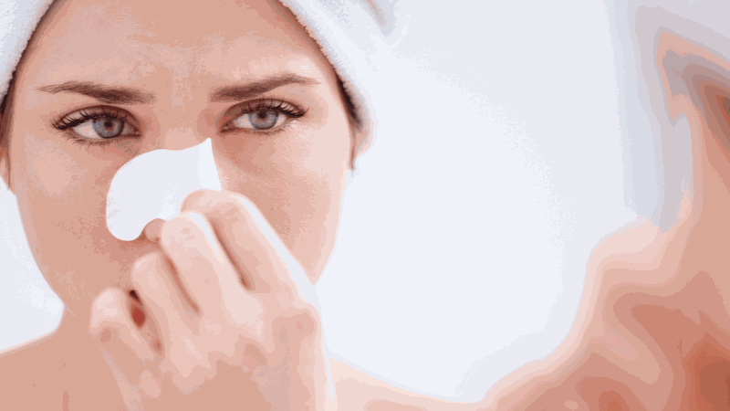 Hướng dẫn nặn mụn đầu đen ở mũi đúng cách tại nhà 3