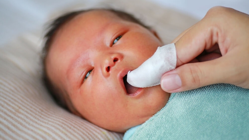 Hướng dẫn rơ lưỡi cho trẻ sơ sinh dễ nhớ, dễ làm 3