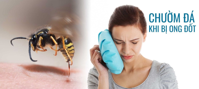 Hướng dẫn sơ cứu ong cắn đúng cách 2