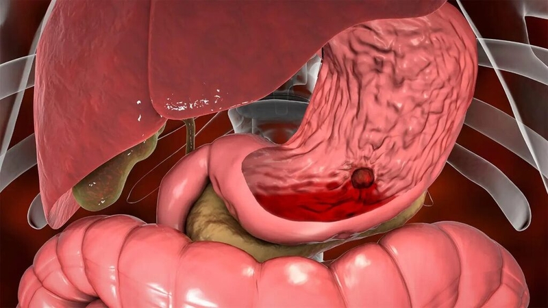 Hướng dẫn sử dụng thuốc aspirin cho bà bầu: Đối tượng chỉ định và chống chỉ định 3