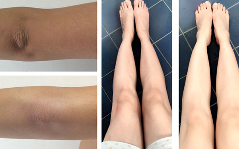 Trị thâm đầu gối bằng baking soda và mật ong đều đặn để đạt hiệu quả tốt nhất