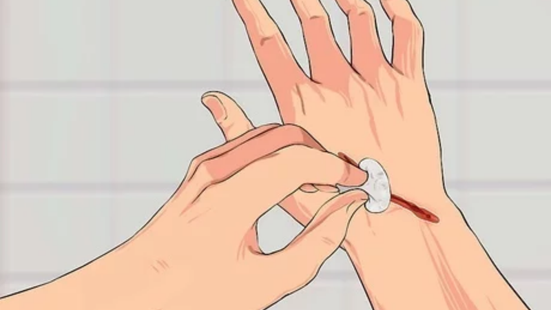 Hướng dẫn xử lý vết thương uốn ván đúng cách 3