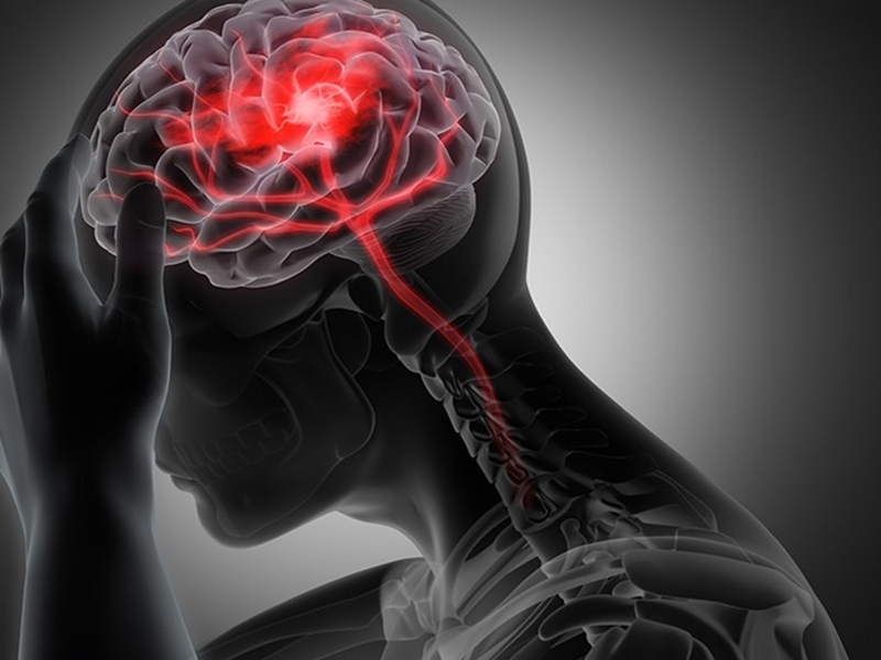 Hướng điều trị và chăm sóc người bệnh nhồi máu não lỗ khuyết 1