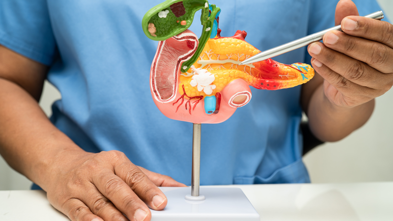 Hướng điều trị viêm tụy cấp và biện pháp phòng ngừa hiệu quả 3