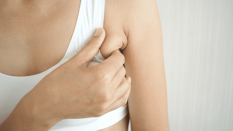 Hút mỡ nách bao nhiêu tiền? Tìm hiểu chi tiết về phương pháp hút mỡ nách 1