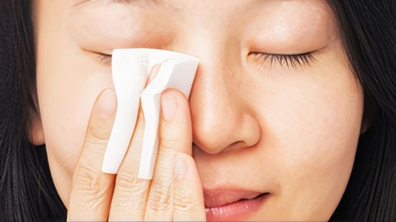 Hút mủ mụn nhọt: Phương pháp khoa học nhất 3