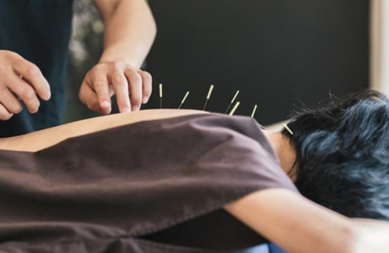 Tuyệt đối không tự tiện thực hiện châm cứu  huyệt á môn khi chưa có sự chỉ định của bác sĩ