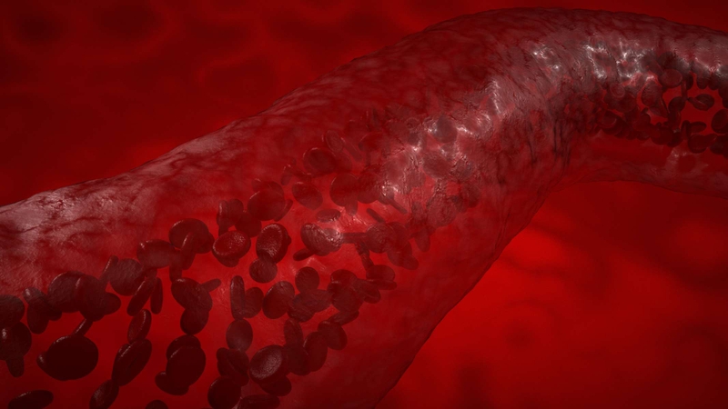 Huyết áp 120/70 là cao hay thấp​? 3