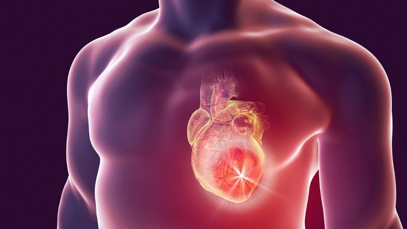 Huyết áp 160/110 có cao không? Cảnh báo mức độ nguy hiểm 3