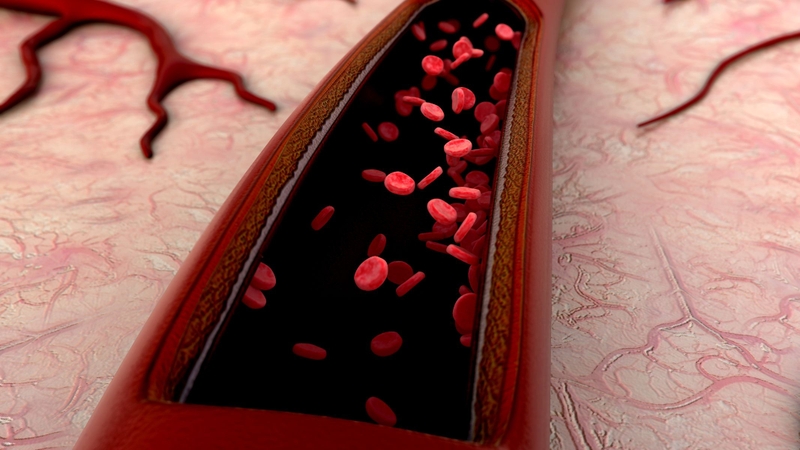 Huyết áp cao có hiến máu được không? 2