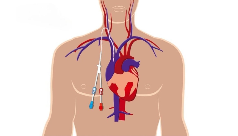 Huyết áp tĩnh mạch: Yếu tố quan trọng trong quản lý bệnh lý tim mạch 1