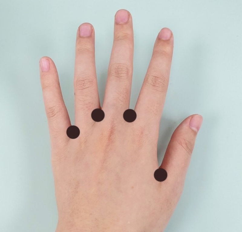 Huyệt Bát Tà ở đâu và ứng dụng huyệt trong việc chữa bệnh?1