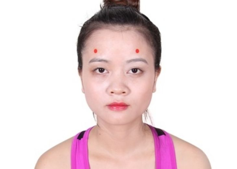 Huyệt Dương Bạch giúp giảm tổn thương có nguồn gốc từ dây thần kinh số V