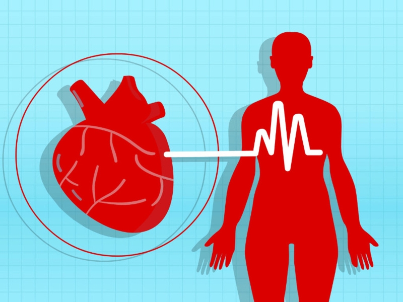 Huyết khối trong tim: Nguyên nhân, triệu chứng, chẩn đoán và điều trị 2