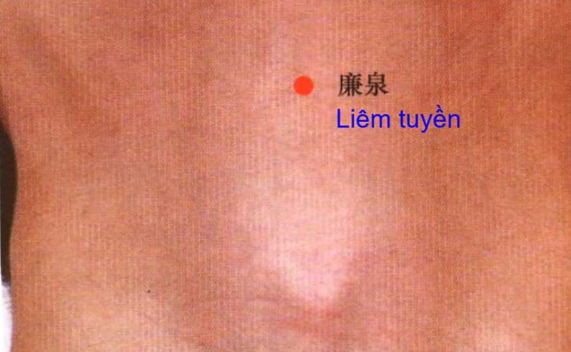 Huyệt Liêm Tuyền là huyệt gì? Cách phối hợp huyệt như thế nào? 1