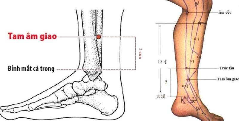 Bấm huyệt tam âm giao là phương pháp tác động hỗ trợ điều trị một số bệnh lý