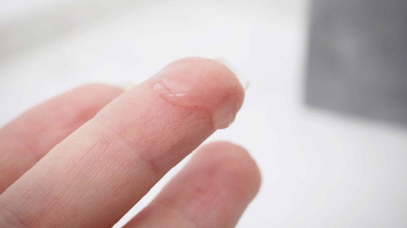 Huyết trắng bình thường là như thế nào? Một số lưu ý 1