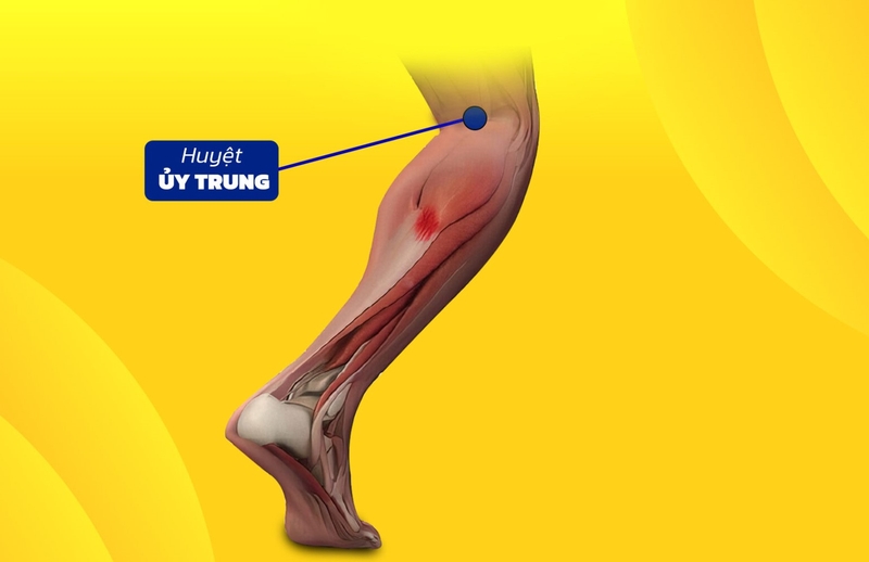 huyệt ủy trung là huyệt gì