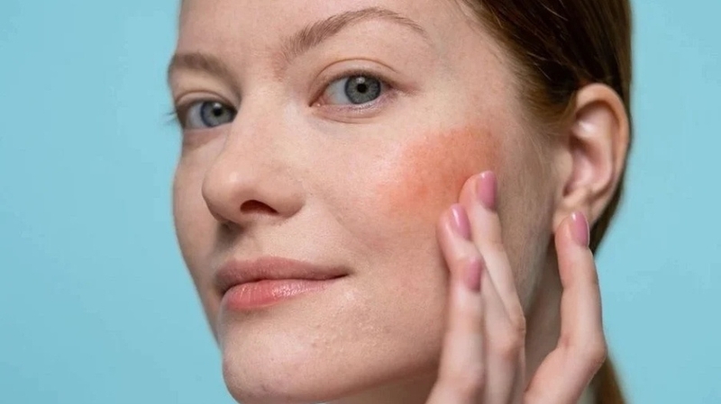 Hyaluronic Acid có tác dụng gì với da? Bí quyết dưỡng ẩm và trẻ hóa làn da hiệu quả 1