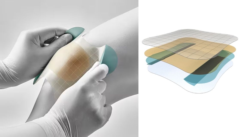 Miếng dán Hydrocolloid giúp bảo vệ và hỗ trợ phục hồi da tổn thương