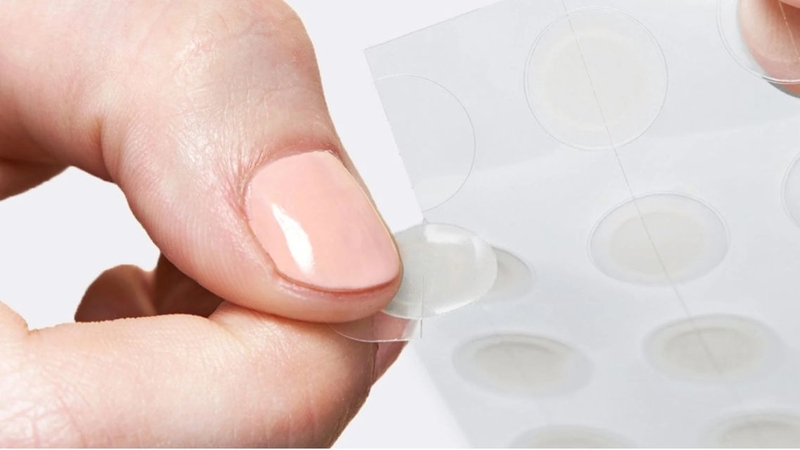 Hydrocolloid thường được dùng trong chăm sóc mụn viêm và vết thương nhỏ