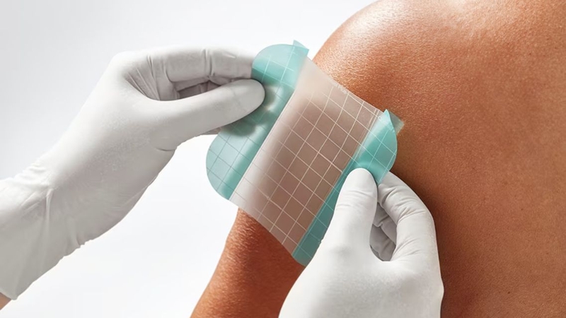 Cơ chế giữ ẩm của Hydrocolloid hỗ trợ quá trình tái tạo da tự nhiên
