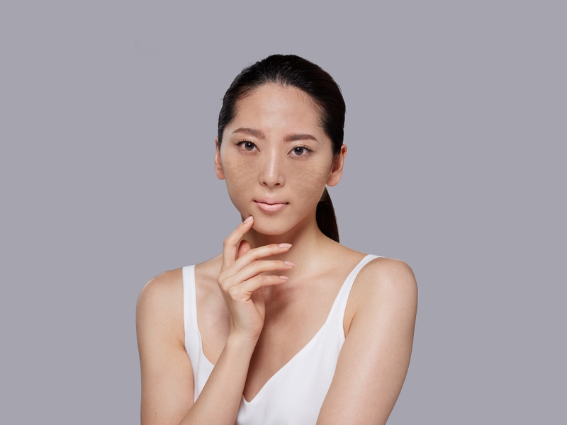 Hydroquinone là gì? Công dụng và cách sử dụng an toàn 4