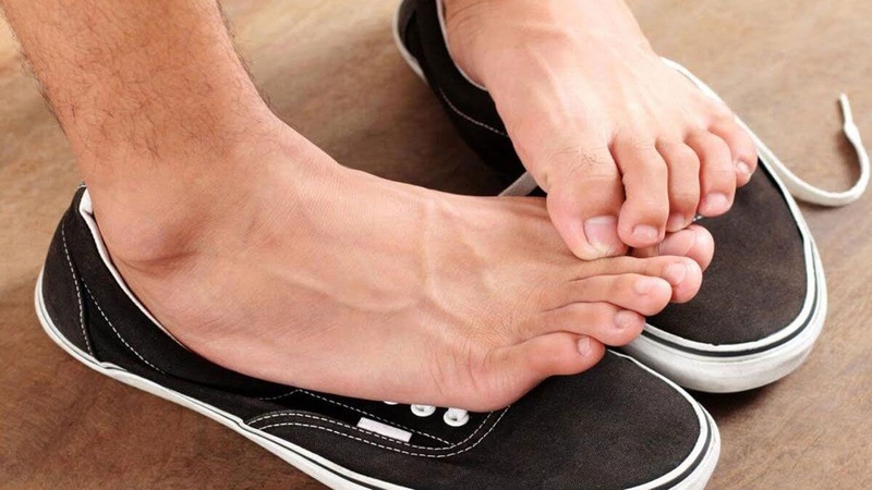 Phòng ngừa nấm da bàn chân như thế nào? 1