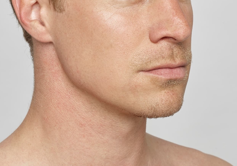 Jawline là gì? Các bài tập luyện jawline hiệu quả 3