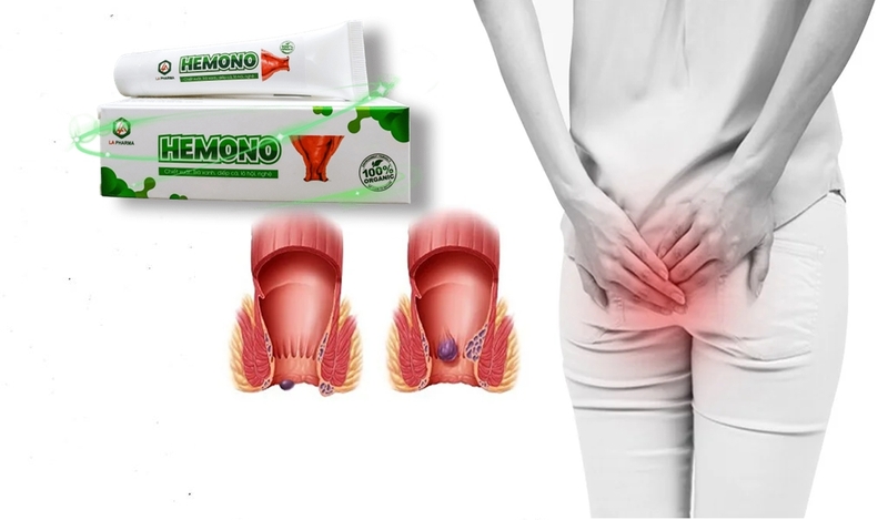 Kem bôi trĩ chiết xuất thiên nhiên: Hemono gel