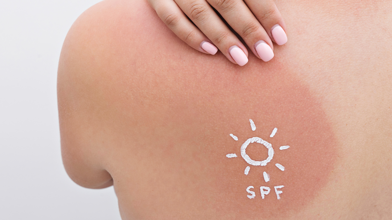 Kem chống nắng có chỉ số SPF càng cao càng tốt không?