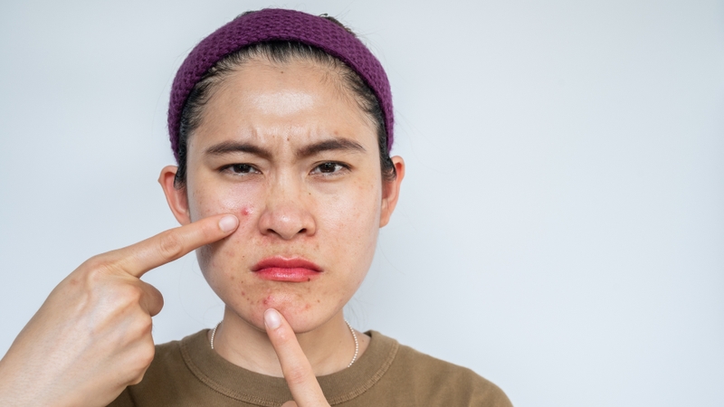 Kem chống nắng dành cho da dầu mụn La Roche-Posay Anthelios Uvmune 400 1