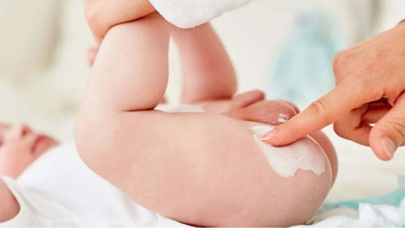 Kem đa năng Zinc Ointment Abena: Lành tính và chống hăm hiệu quả! 1