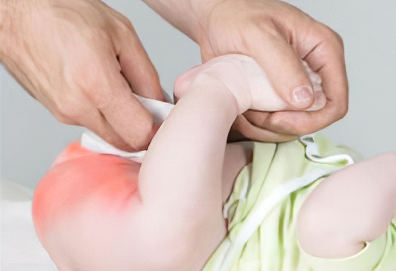 Kem dưỡng ẩm chống hăm: Vị cứu tinh ngừa hăm da ở trẻ! 1