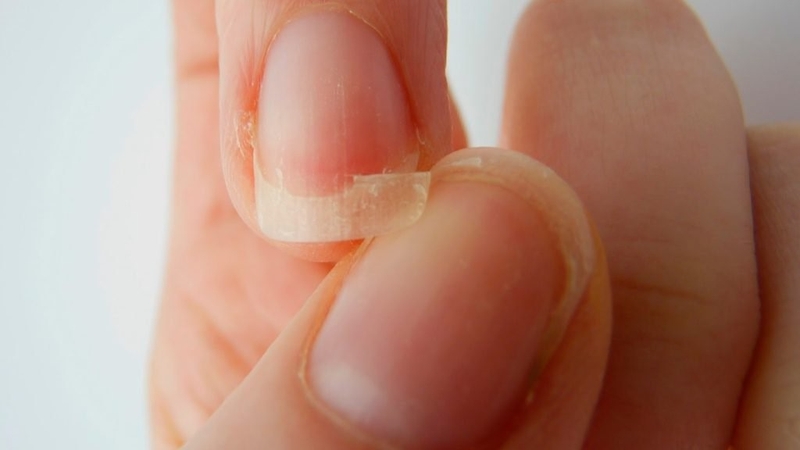 Kẽm Glycinate là gì? Khoáng chất vi lượng quan trọng 4.jpg