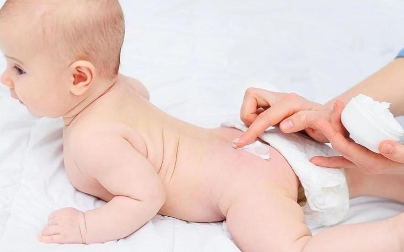 Kem hăm Sudocrem của nước nào? Có hiệu quả ra sao? 2