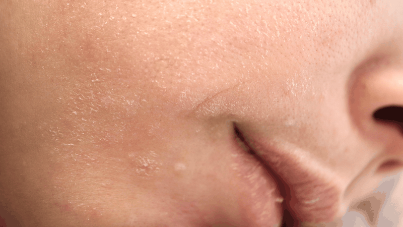 Kem nẻ Valentine có bôi mặt được không? Câu trả lời là có thể