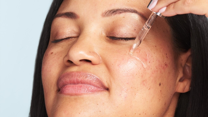 Kết hợp niacinamide và azelaic acid có tác dụng gì? Cách dùng ra sao? 1