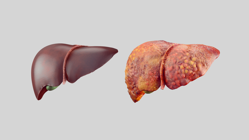 Kết quả đo mức độ xơ hóa gan có ý nghĩa như thế nào? Quy trình thực hiện đo 1
