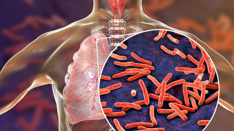 ket-qua-xet-nghiem-adenosine-deaminase-co-y-nghia-gi 2.jpg