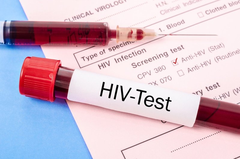 Test nhanh HIV AB cho kết quả có độ nhạy cao nhưng độ đặc hiệu thấp