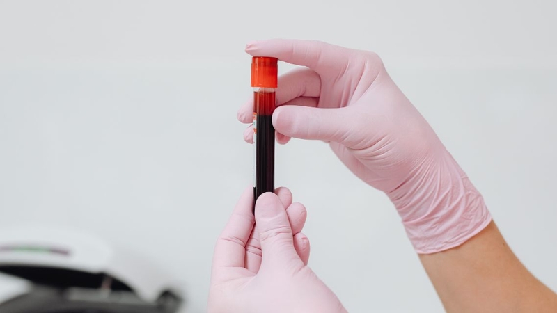 Kết quả xét nghiệm HIV âm tính không phải lúc nào cũng loại trừ hoàn toàn nhiễm HIV