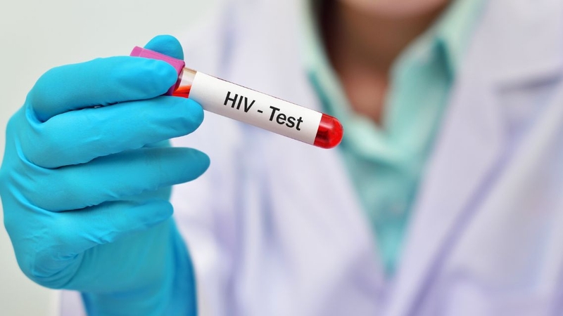 Thời điểm xét nghiệm quyết định độ tin cậy của kết quả HIV âm tính