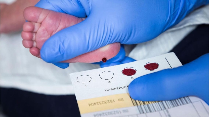 Giá trị tham chiếu có thể thay đổi nhẹ tùy phòng xét nghiệm