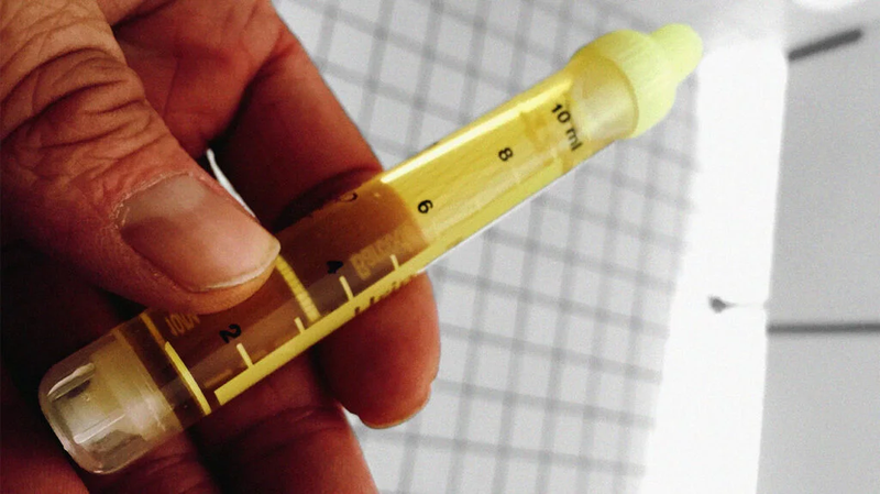 Khám bệnh lậu và những điều cần biết về dấu hiệu phát bệnh ở nam nữ 4