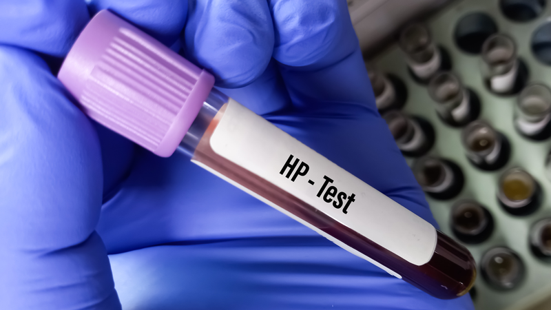 Khám dạ dày: Phương pháp, lưu ý và đối tượng cần thực hiện 3