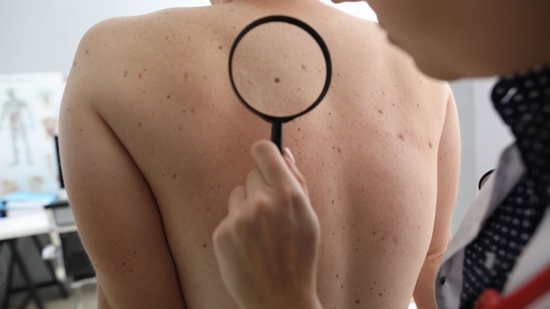 Khám da liễu TPHCM ở đâu chất lượng uy tín - 3