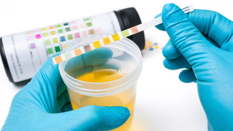 kham-he-tiet-nieu-nhung-dieu-can-biet 3