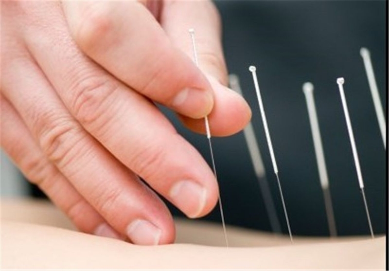 Khám phá 5 bước sơ cứu đột quỵ não đúng cách 3